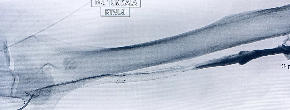 Venkat Tummala MD MBA tweet media