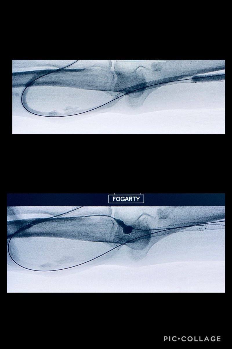 Venkat Tummala MD MBA tweet media