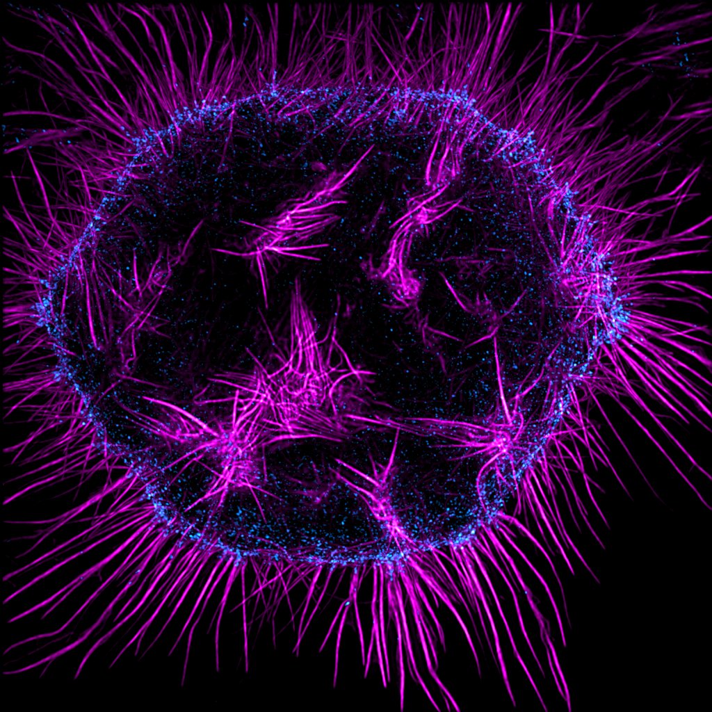 MAG2ART's tweet image. Holy Retraction Fibers Batman!
When cells round up during mitosis, they often remain connected to the substrate by specialized actin bundles called retraction fibers. Sometimes they form a lot...
Actin in this cell in metaphase is shown in purple.
#CellBiology #microsocpy #SciArt