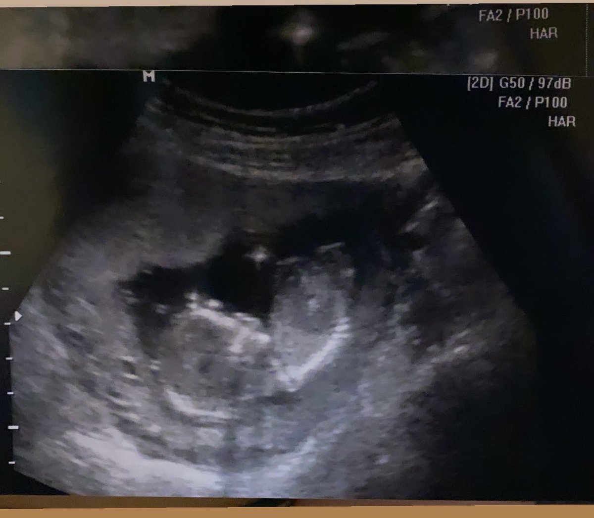 turtle797's tweet image. 6 more months until our little munchkin is here❤️🥺