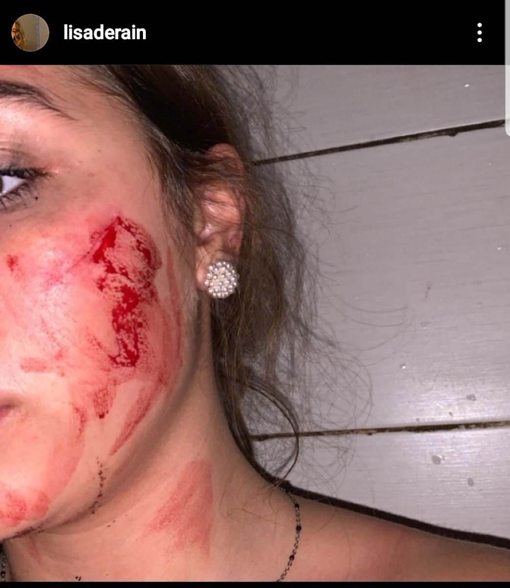 mdetp__'s tweet photo. faites attention hier soir jai une copine qui en rentrant chez elle sait faite agresser, un homme est venue avec un cuteur et la agresser, elle rentrait juste des cours elle n'avait rien fait. Soyez prudent/prudente https://t.co/nrjzESzhic