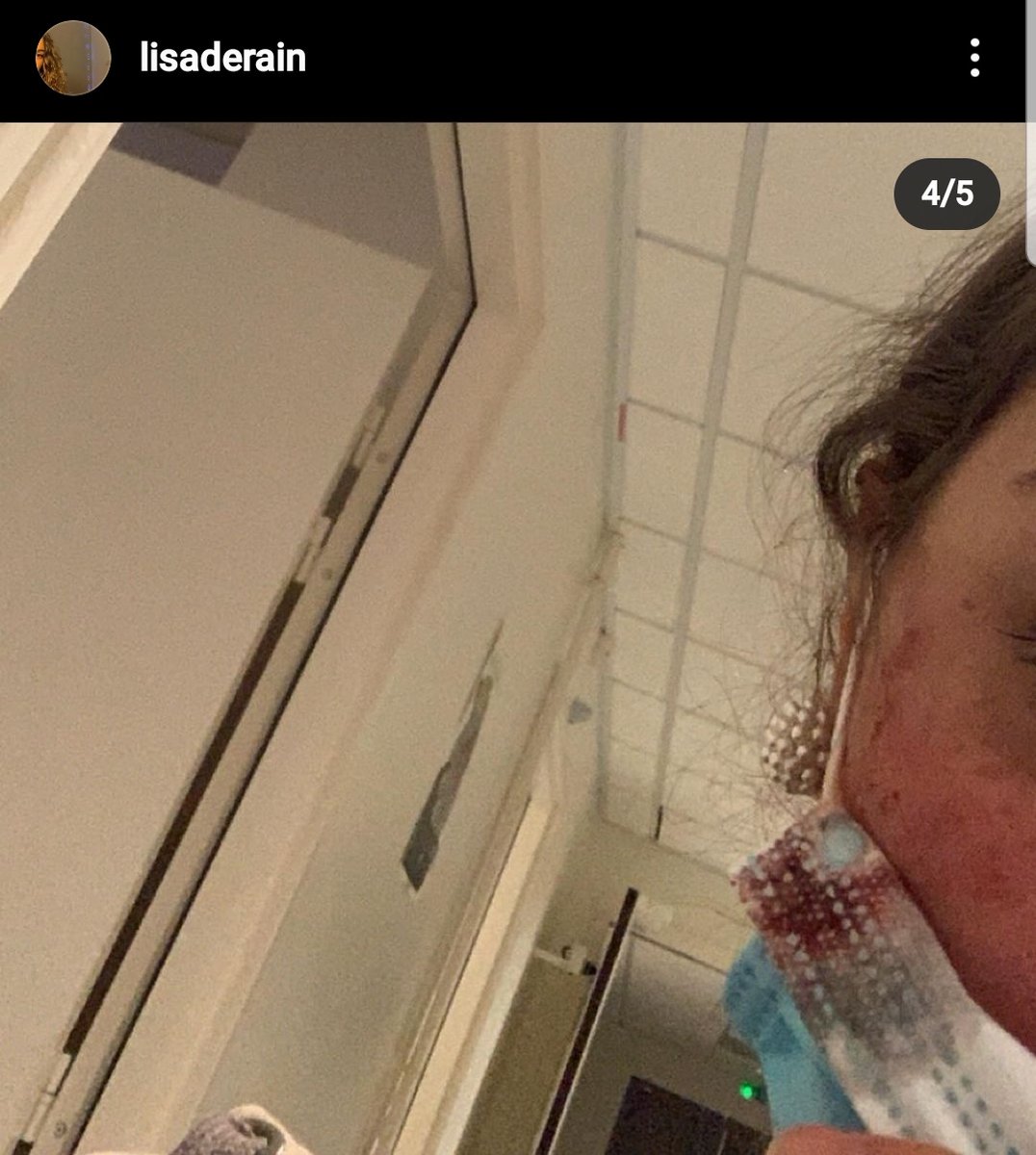 mdetp__'s tweet photo. faites attention hier soir jai une copine qui en rentrant chez elle sait faite agresser, un homme est venue avec un cuteur et la agresser, elle rentrait juste des cours elle n'avait rien fait. Soyez prudent/prudente https://t.co/nrjzESzhic