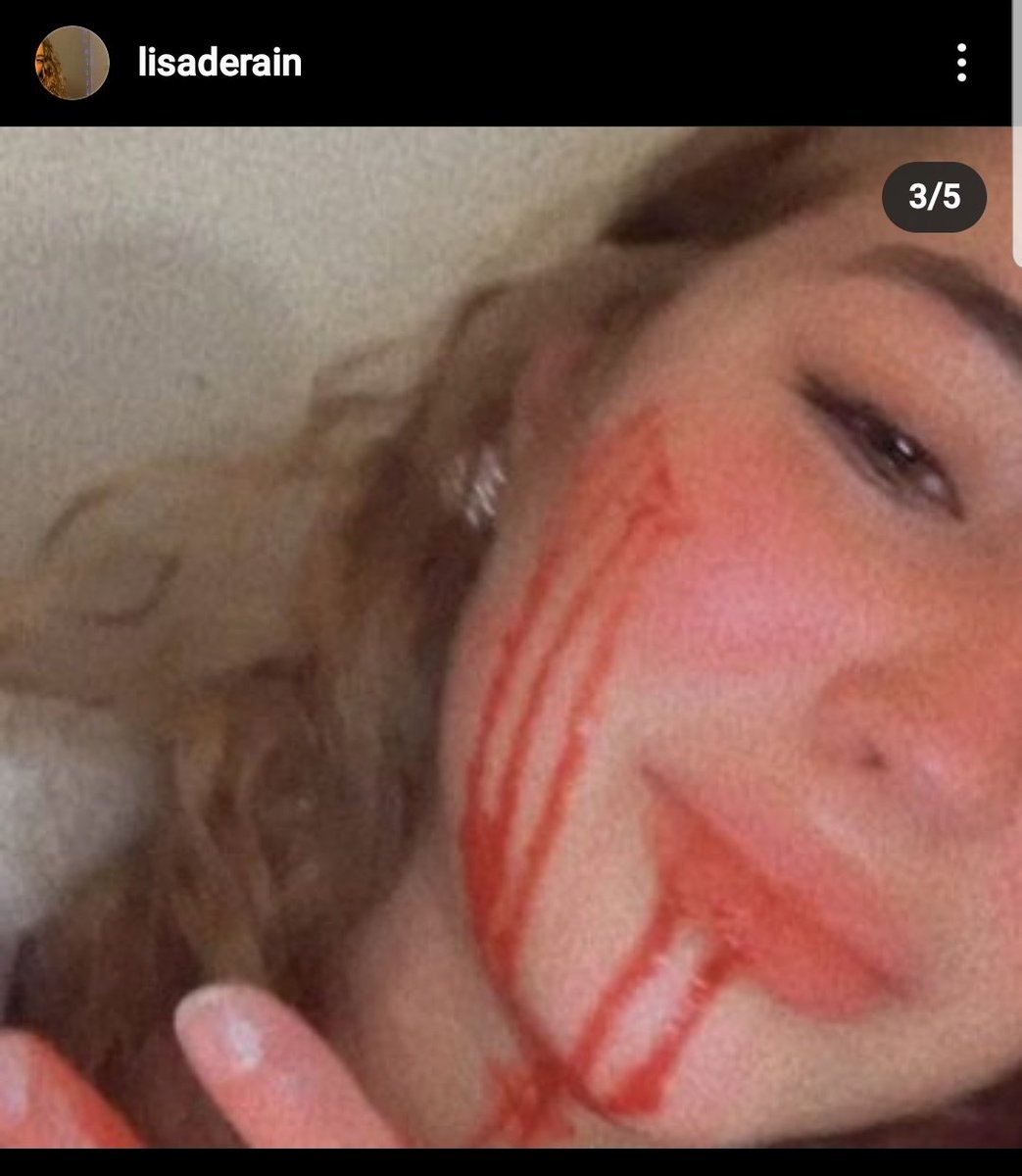 mdetp__'s tweet photo. faites attention hier soir jai une copine qui en rentrant chez elle sait faite agresser, un homme est venue avec un cuteur et la agresser, elle rentrait juste des cours elle n'avait rien fait. Soyez prudent/prudente https://t.co/nrjzESzhic