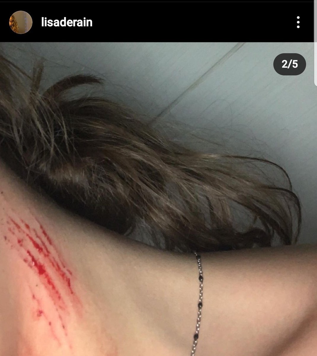 mdetp__'s tweet photo. faites attention hier soir jai une copine qui en rentrant chez elle sait faite agresser, un homme est venue avec un cuteur et la agresser, elle rentrait juste des cours elle n'avait rien fait. Soyez prudent/prudente https://t.co/nrjzESzhic