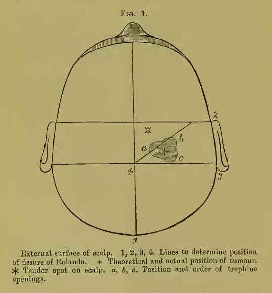 Jonathan Pollock tweet media