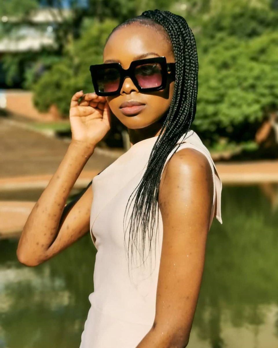 Mohau_Tinkie's tweet photo. We got to celebrate our achievement and show our scars for the first time (after hiding for 6 months). Both are big wins for me.
#misstembisa2019 #queenof1632 #ujstratcomm @go2uj https://t.co/CQS3R2TaFn