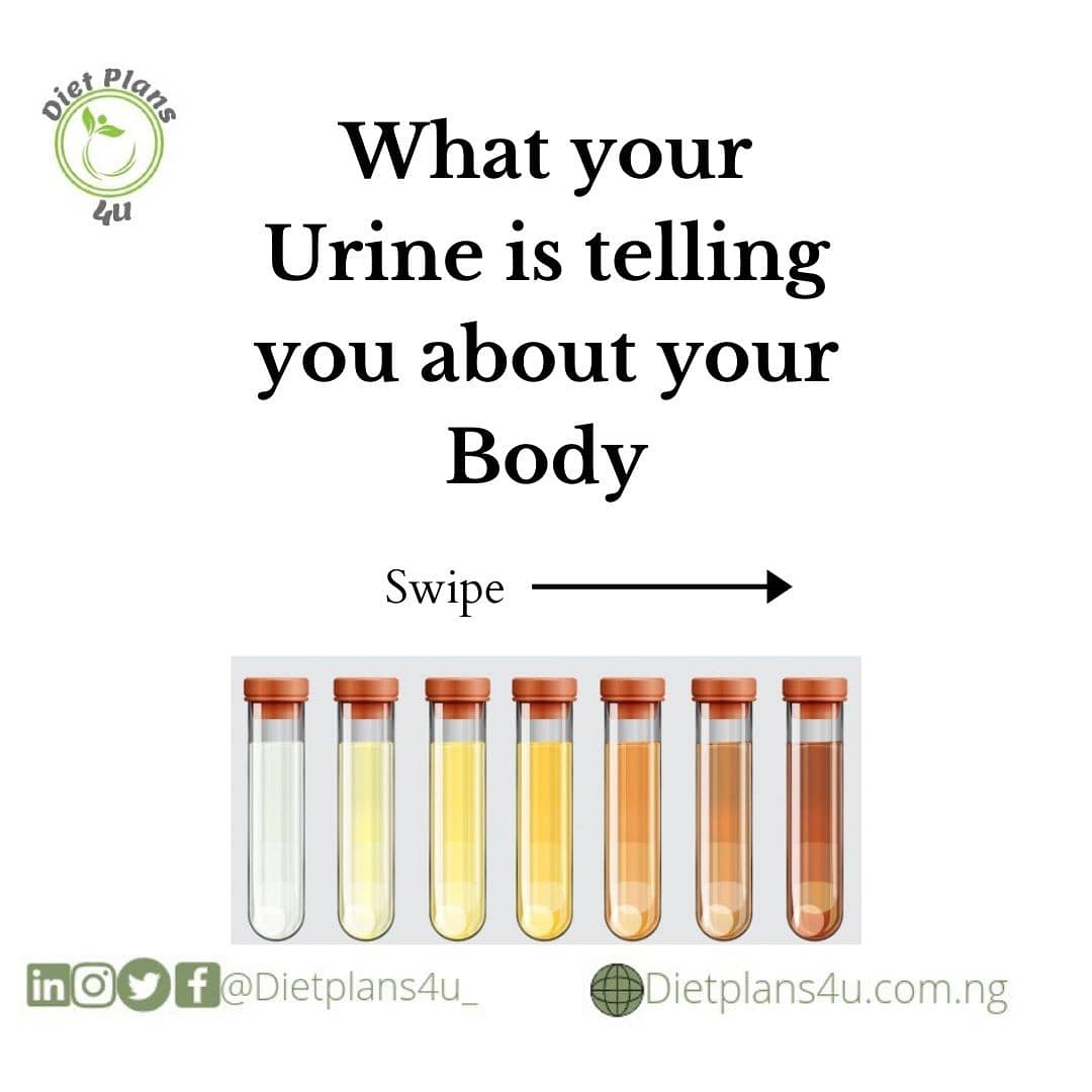 MetabolicH_ng's tweet photo. What your urine colour is telling you about the level of water in your body. ⬇️⬇️⬇️

#Urinecolour https://t.co/wgWRYyc7YT