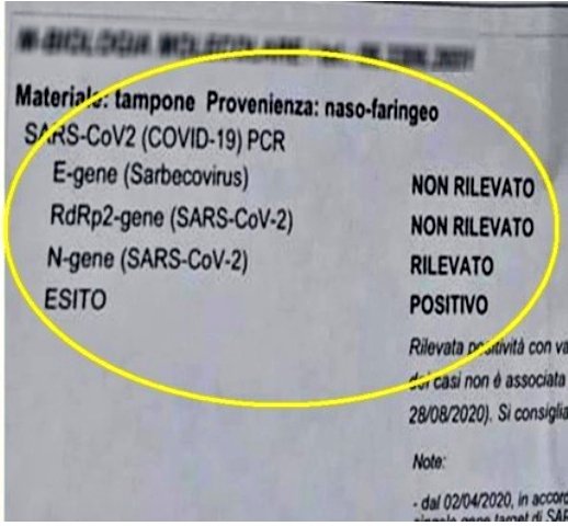 Stefano Scoglio: swabs look for 3 genes characterizing SARS-CoV-2: E gene, RdRp gene & N gene. "If the virus were present, all 3 would have to be found, because if the virus is intact, the only case in which it can have a pathogenic role & infect, the test must find all 3 genes"