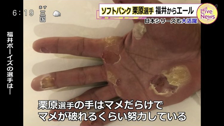 滝沢ガレソ Luciole 0603 代理でペッパーくんに手マンしてもらってるらしいです Twitter
