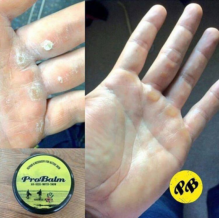 TeamProBalm's tweet image. We'll let the ProBalm speak for itself... 😉

Get yours here: bit.ly/2HFhhi0