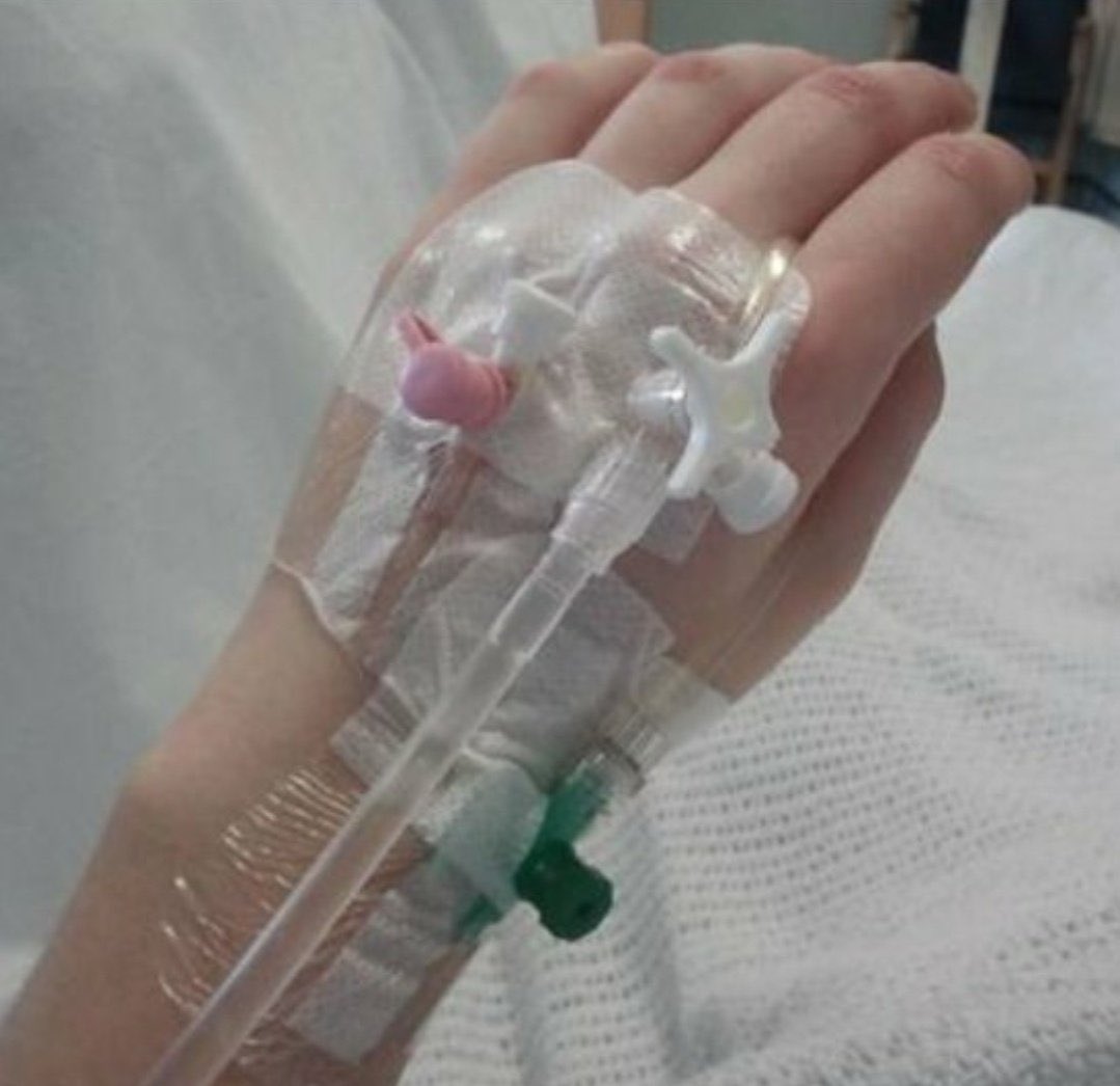 Durumlar şimdikilik böyle hepinizi özledim 😔 dm bi şey olmuş gitmiyor Limit değil yarın yine amaliyat var doktor her şey yolunda diyor inşallah hepinizi özledim ❤