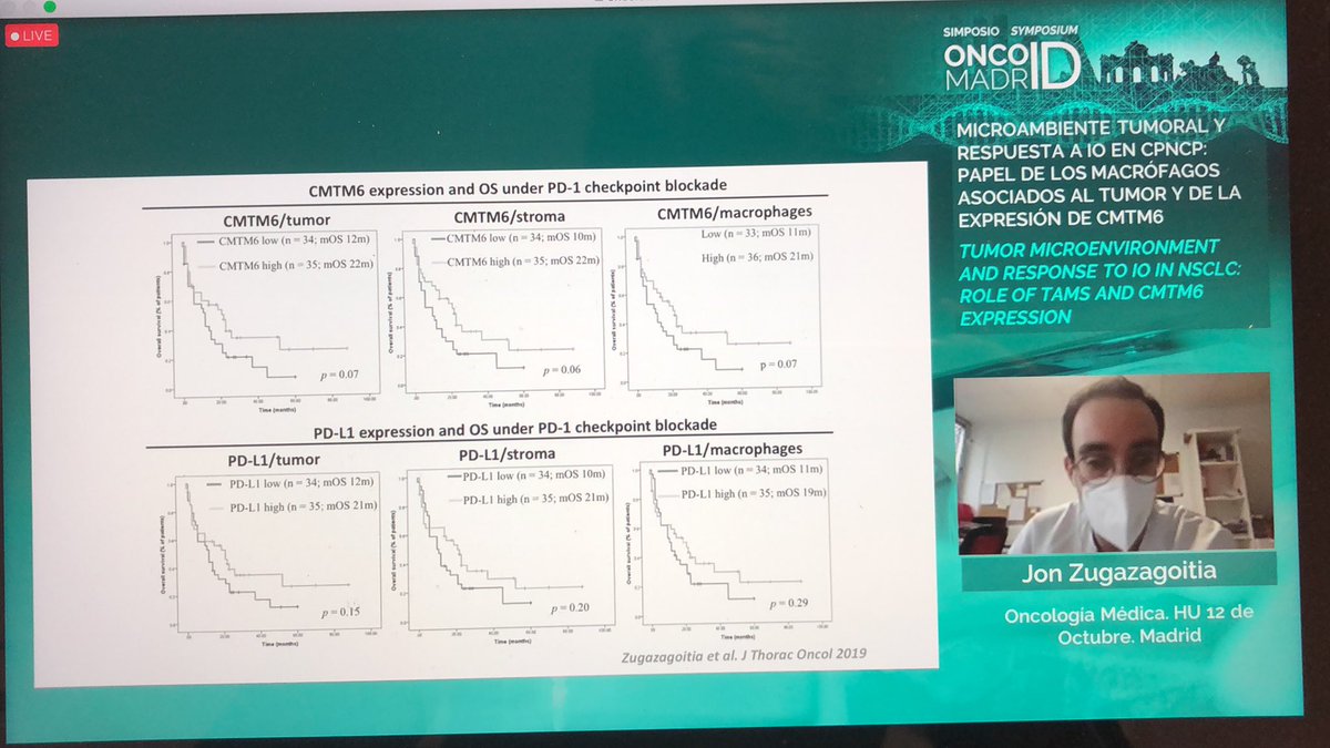 SantiCabezas1's tweet photo. Expresión de #CMTM6 en célula inmune asociada al tumor en #CancerdePulmon #lungcancer , en concreto en #macrofagos #macrophages #CD68 @GEPAC_ @SEAP_IAP @gecp_org @ASEICAnews @FECYT_Ciencia @jon_zuga @AndresFCardonaZ @M_SoteloLezama @MARIANOPROVENCI https://t.co/z1Mr8maeSM