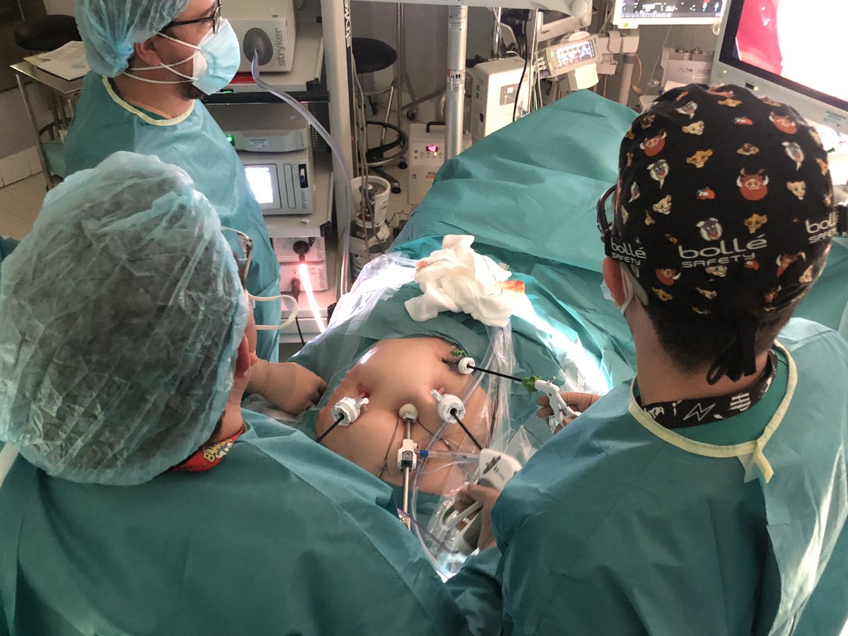 laparostato's tweet photo. Abordaje laparoscópico en una etapa de adenocarcinoma de sigma con metástasis hepatica única en segmento V. Gran trabajo 👏🏼👌🏼👨⚕️ @Curro_Blanco @JoseRoschow @trubiss @seccionhbpaec @AlbertoIsla1 @almagoch @cjGomez22 @aqxdemy @Cesar_Ginesta @aecformacion @FueyoA @sacyl https://t.co/VNkmoBp1M1