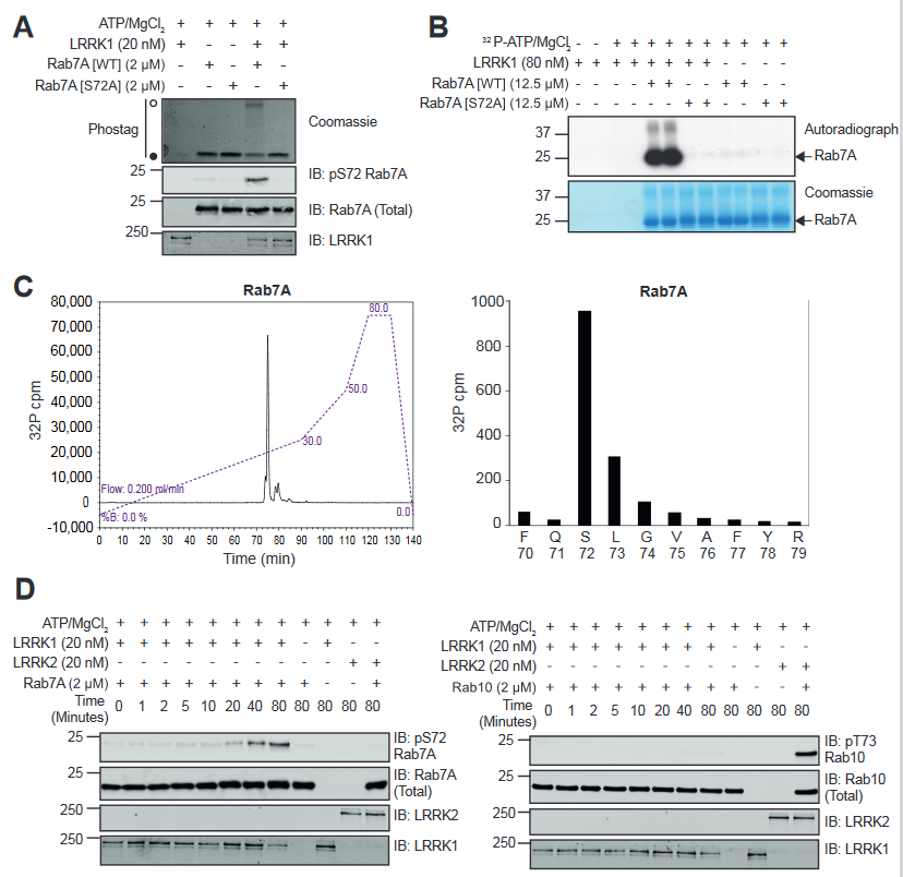 ScienceofPD's tweet photo. New @biorxivpreprint from @asadm96 &amp; @mrcppu colleagues reinforces the idea that the LRRK enzymes have evolved as major regulators of Rab biology; Interesting: Widely used LRRK2 inhibitors being developed for #Parkinsons do not inhibit LRRK1
https://t.co/vW9ZnIKeEH https://t.co/6CXlXKOQ98
