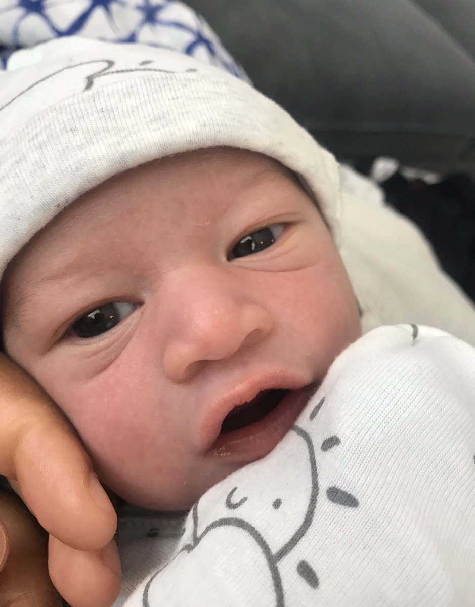 A photo of a baby looking curiously at the camera.