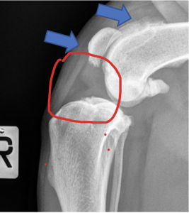 woofstock's tweet photo. ACL injuries in humans can be brought on by sport-related trauma but that's not the case in dogs. Check out our latest Letter From The Vet by @Animal_Partners to learn more about how to spot the problem &amp; what you can do to help your pup https://t.co/8REHdnsgbi #dogowner #dogs https://t.co/CoIltnUEJb