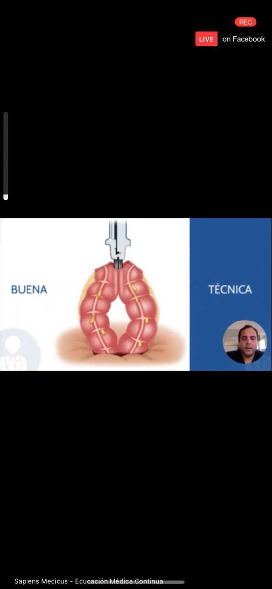 drhomerorod's tweet photo. Excelente organización. Gracias por la oportunidad de compartir una velada académica @amcgmx @panamasurgical @PacificaSalud #colorectalsurgery #SoMe4Surgery https://t.co/fvW5tRvQn4