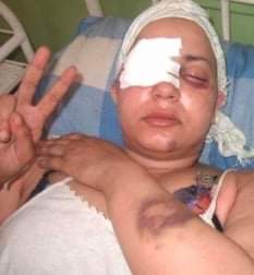 SaharaMehdi's tweet photo. عندما يعجز العدو عن مقارعة الرجال يلجي الي اضطهاد القوارير هذا ما يحدث لنساء الصحراويات بالمناطق المحتلة من طرف قوات المخزن المغربي https://t.co/t0JyMV55Sq