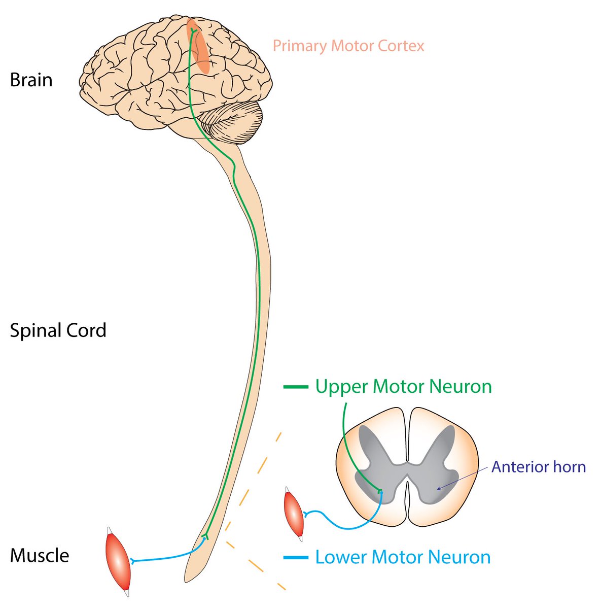 أمراض_العصبون_الحركي Motor_Neuron_diseases MND هي مجموعة من الامراض