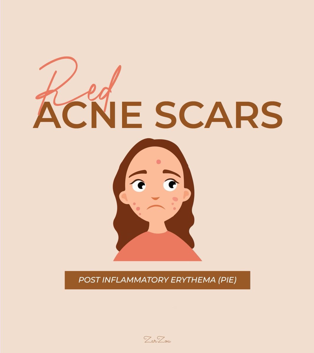 You nak hilangkan acne scars yang warna merah atau nama lain dia Post Inflammatory Erythema (PIE)? Dah macam2 product guna tapi susah sangat nak nampak kesan?Then this thread is for you! 