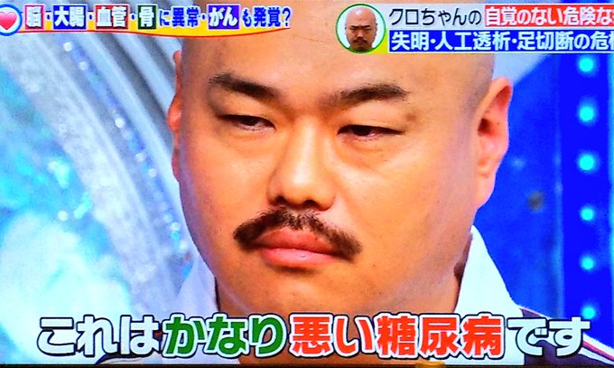 クロちゃん 番組で 重度の糖尿病 と診断される ガチでやばいのにもつ鍋を ヘルシー と食す まとめダネ クロちゃん 番組で 重度の糖尿病 と診断される ガチでやばいのにもつ鍋を ヘルシー と食す まとめダネ