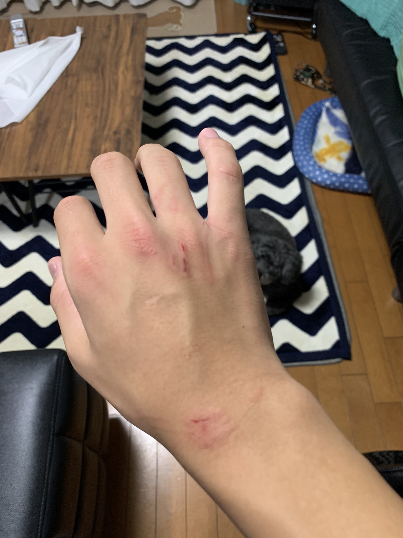 アジフライtvなたお アジフライtv 犬 犬に噛まれた ミミズ腫れ いたい 帰ってきてーいつものわ っ 犬 てやつ やってたらバリバリになったスプーン発見して ままにとってって言ったら犬がとんでこうとしたからおさえたら やられた 文章力なくて