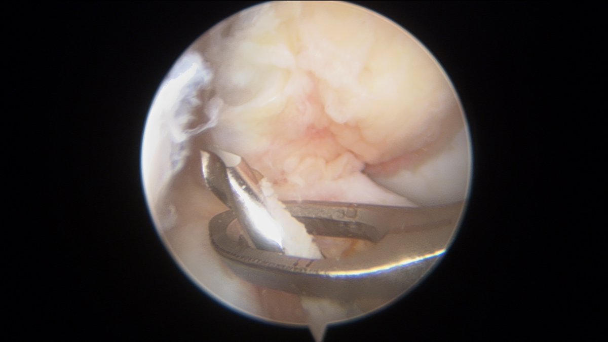 Gustavo Pineda (@rodilladrpineda) on Twitter photo 