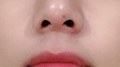 his cutest mole