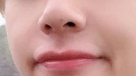 his cutest mole