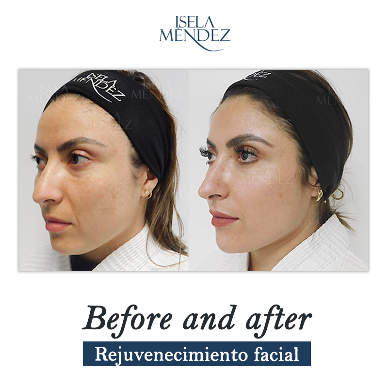 Isela Méndez tweet media