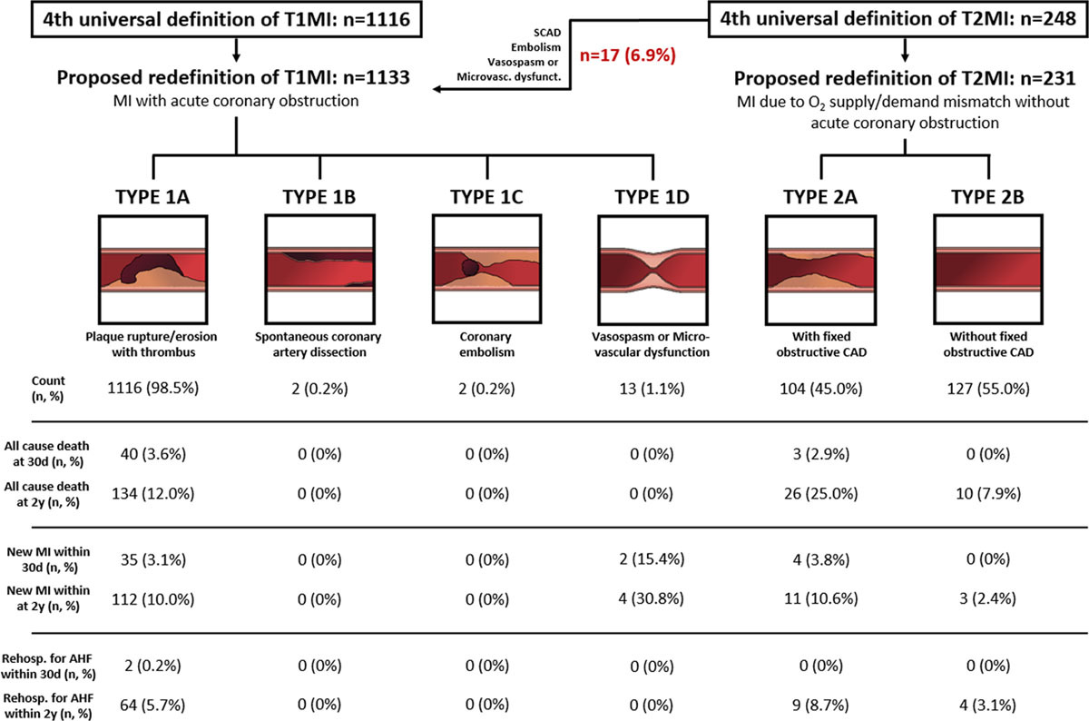 CircAHA's tweet photo. #ResearchLetter: Effect of a Proposed Modification of the Type 1 and Type 2 Myocardial Infarction Definition on Incidence and Prognosis https://t.co/pN6UtiBFqe #AHAJournals https://t.co/vO98vVnm3O