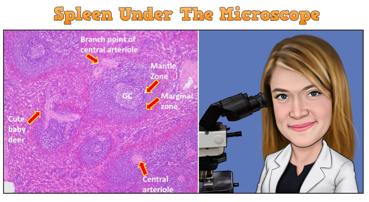 X-WOW (@x_wowcom) on Twitter photo Another #Pathology4Kids is here! By <a href="/evemariecrane/">Genevieve Crane, MD, PhD</a> 😀
"Hey, Kids! Did you know? The spleen filters blood, removes old and damaged red blood cells and helps to recycle them. Immune cells keep a close eye on passing blood for any pathogens to mount a response and keep us safe!" Another #Pathology4Kids is here! By <a href="/evemariecrane/">Genevieve Crane, MD, PhD</a> 😀
"Hey, Kids! Did you know? The spleen filters blood, removes old and damaged red blood cells and helps to recycle them. Immune cells keep a close eye on passing blood for any pathogens to mount a response and keep us safe!"