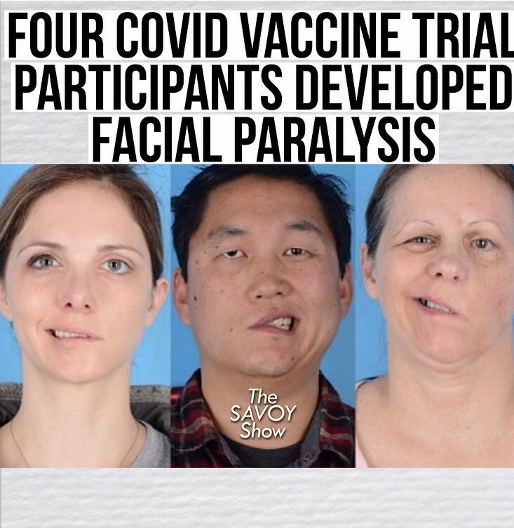 _RomeoSavi_'s tweet photo. Y’all got the game all the way fucked up. “My brother hit me in the face with a shovel” Ass Shit😂😂 #covid19 #vaccine #fawkyoumean https://t.co/bJjTCN490Q