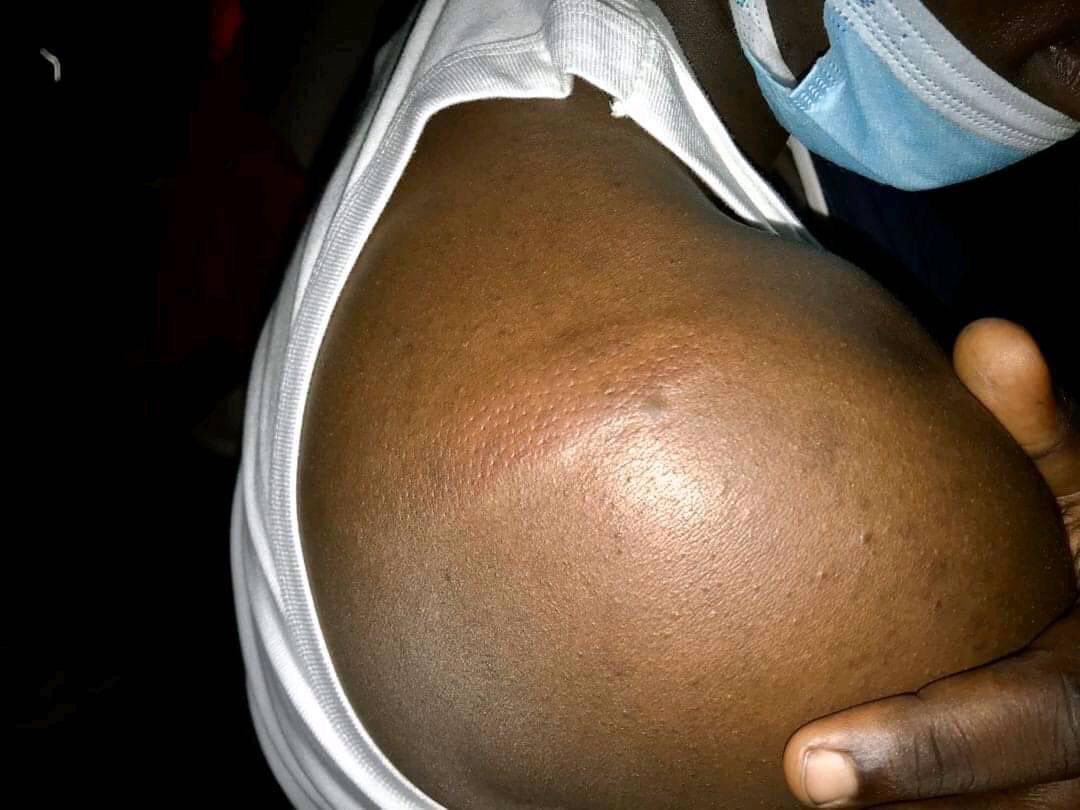 Police and military have beaten  journalists namely John Cliff Wamala (NTV), Sesanga Batte (BBS), Tamale (BUKEDDE) 

Their crime : covering what’s happening along Ngeta road in Lira district where Bobi and his team have been held since 1;00pm 💔