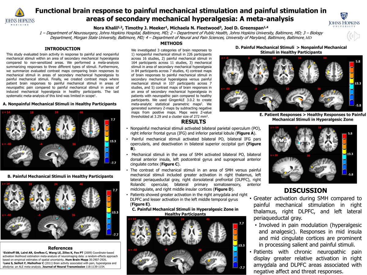 neural_Tim's tweet image. Nora Khalil&apos;s Poster on Meta-analysis on Central Correlates of Mechanical Pain and Hyperalgesia at #USASP2020