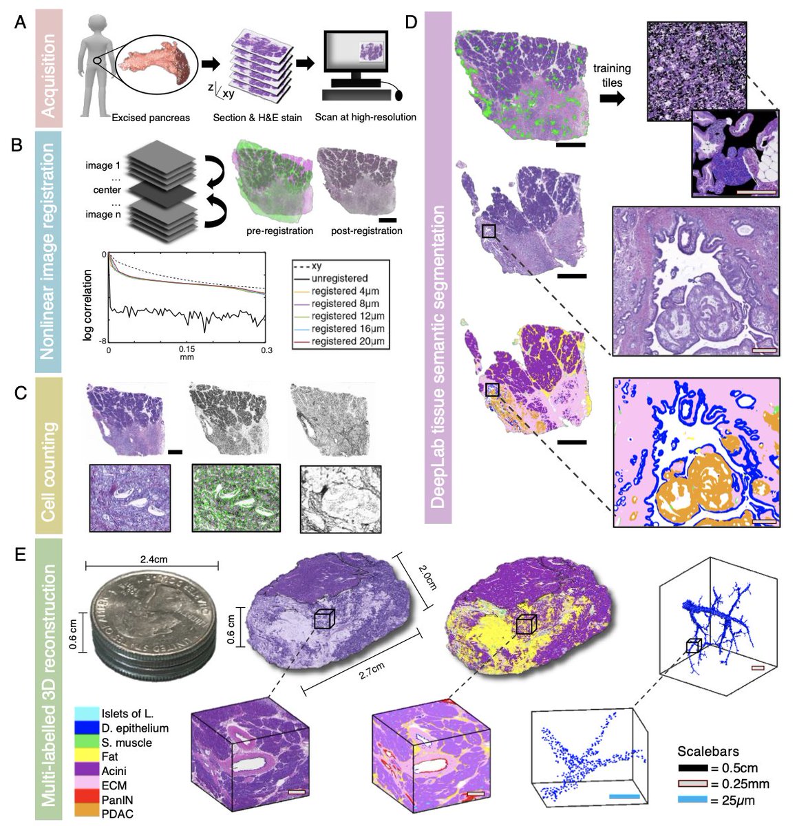 deniswirtz's tweet image. We present a method to produce 3D maps of large volumes (multi cm^3) of human tissues and tumors at single-cell resolution.
See more details here: biorxiv.org/content/10.110…