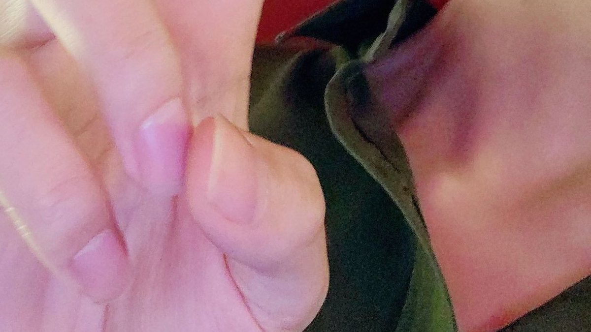 doll tae (@hourlydolltae) on Twitter photo 