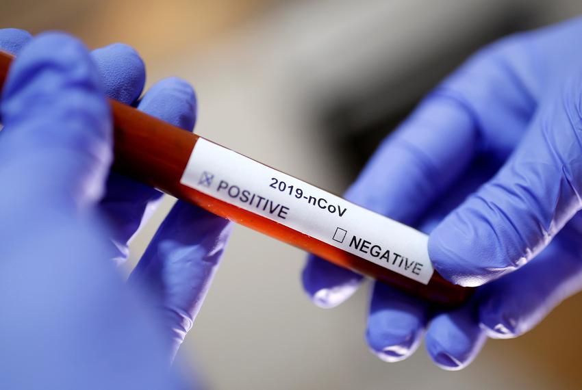  #BayesTheorem in simple terms: when medical mass testing includes asymptomatics & the disease affects a minority of the population, a very small margin of error in the testing process will mathematically result in the false positives being many times more than the real positives.