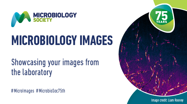 MicrobioSoc's tweet photo. There is still time this year to submit your #MicroImages. Help us to showcase #WhyMicroMatters and share your images with us today. https://t.co/FC6L8Tikek https://t.co/VRHlx17cLB