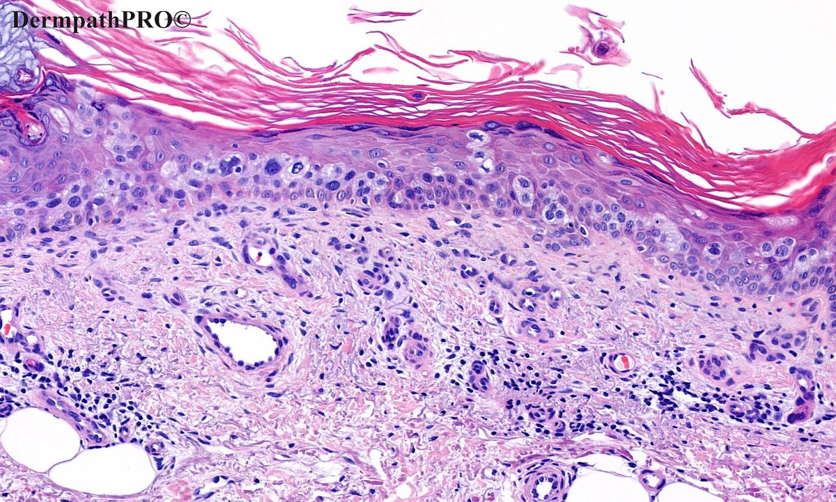 DermpathPRO tweet media