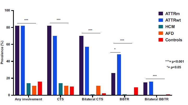 ATTR-CA patients have at least one upper limb tenosynovial involvement in 82% of cases