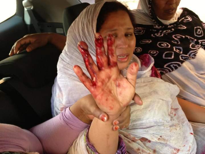 med_hakima's tweet photo. #اليوم_العالمي_لحقوق_الإنسان 
  هذا ما يتمتع به الصحراويين  من حقوق في ظل الاحتلال المغربي
#البوليساريو_تنتصر 
#freewesternsahara https://t.co/fZBXwNkaKv