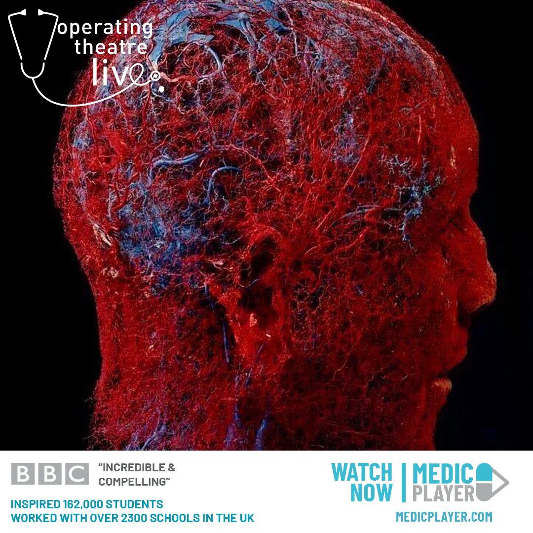 This is a picture shows a human head with actual blood vessels. 😍😍

If you're interested in science and medicine, join us over on <a href="/MedicPlayer/">MEDICPLAYER</a>  as we take a journey into the human body like never before! 👨‍⚕️👩‍⚕️🔪🧠

WATCH NOW ▶️ operatingtheatrelive.co.uk