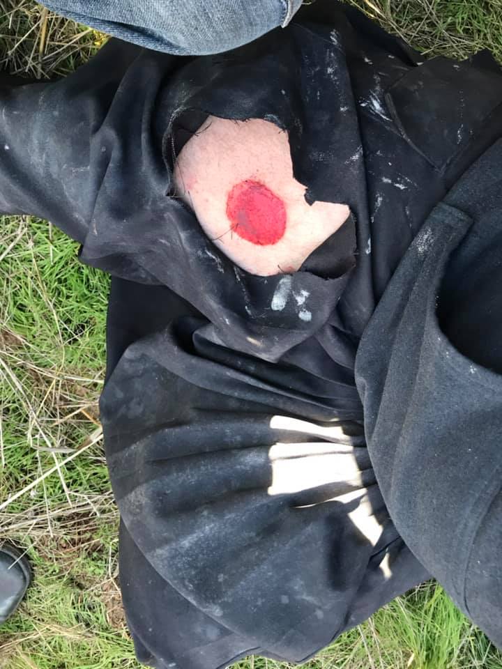 Yesterday Israeli police fired rubber bullets and tear gas at Syrians peacefully protesting in the occupied Syrian Golan, causing numerous injuries. golan-marsad.org/israeli-police…