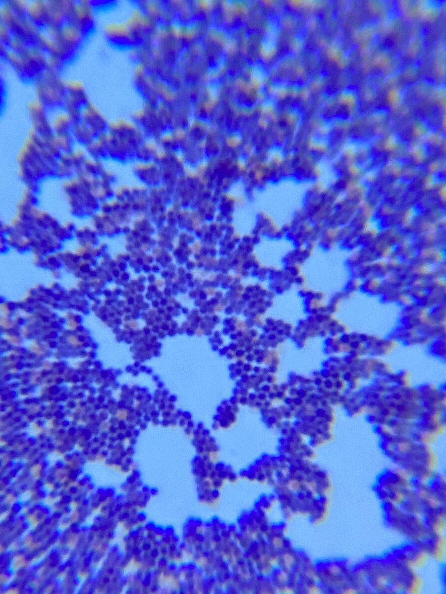 BiomedSci_JCHS's tweet photo. Wow! My level 1 PBS kids amaze me at how well they did with bacterial identification. Their first attempt and we got some great results and their technique makes me excited to have them in class again! #PLTW #RSS_CTE #jchslife https://t.co/9dhIqDSFdd