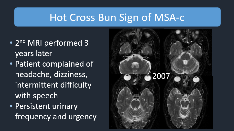 Philip R. Chapman, MD tweet media