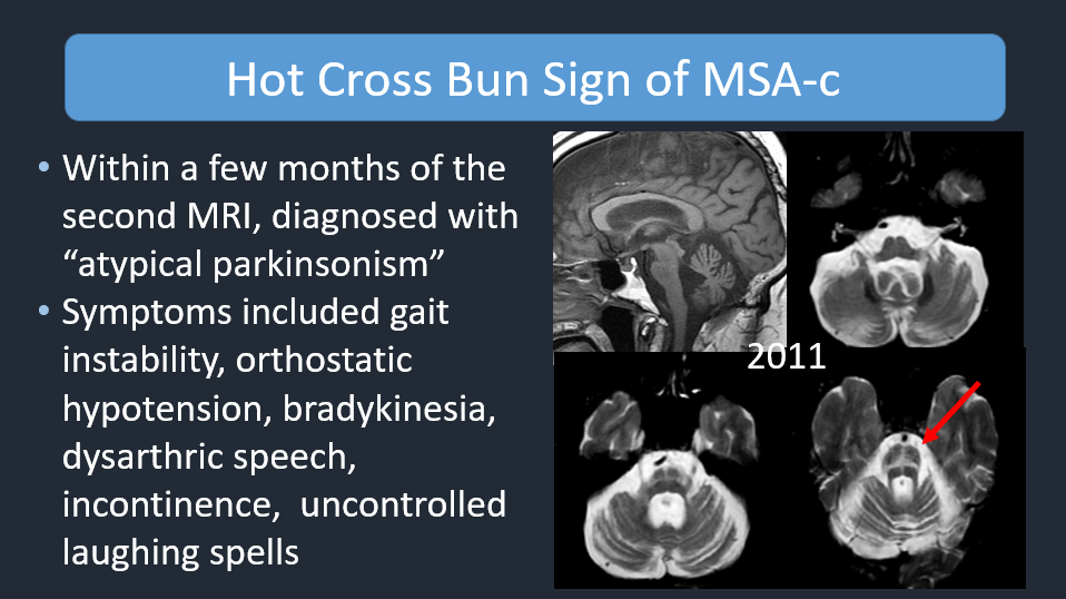 Philip R. Chapman, MD tweet media