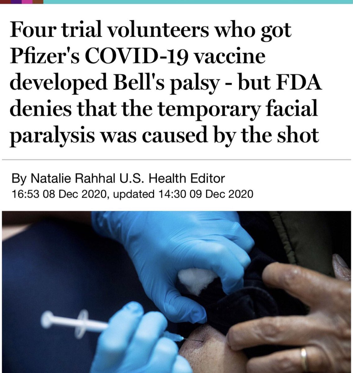 JenniferMarguli's tweet image. Look on the bright side. One of the side effects of Bell’s palsy can be deafness in one ear. Then you’ll no longer be able to hear all the misinformation being spewed by the pharmaceutical industry, the mainstream media, &amp;amp; the Big Tech companies (like censorship-happy Twitter)