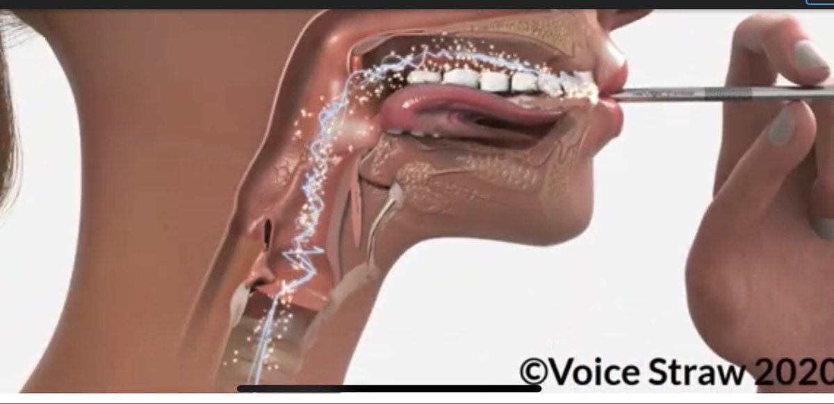 VoiceStraw's tweet image. Learn more about tools for your voice and why any straw is not the same as having the right tool for the right job.

voicestraw.com/pages/the-scie…
#strawphonation #sovt #vocalcoach #singing #singingteacher #voicelessons