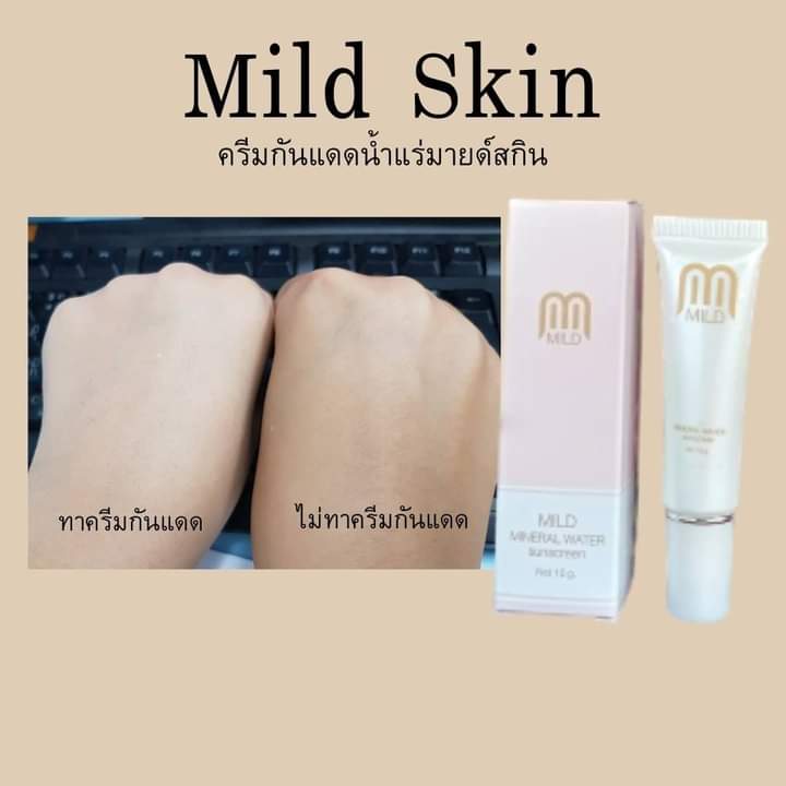 SkinMild's tweet photo. ความแตกต่างของการทา #ครีมกันแดดน้ำแร่มายด์สกิน กับไม่ทา หน้ากระจ่างใส ด้วยผงไข่มุก ตัวบำรุงวิตตามินบี3และอโลดวล่า ที่ใส่ไปในครีมกันแดดขนาด 10กรัม ราคา 239 บาท #ส่งฟรีems 
สั่งซื้อ/สอบถาม/สมัครตัวแทน https://t.co/lCN13EMLsf
#ครีมกันแดด #รีวิวกันแดดน้ำแร่มาสด์สกิน #หน้ากระจ่างใส https://t.co/RYhKNlQWbs